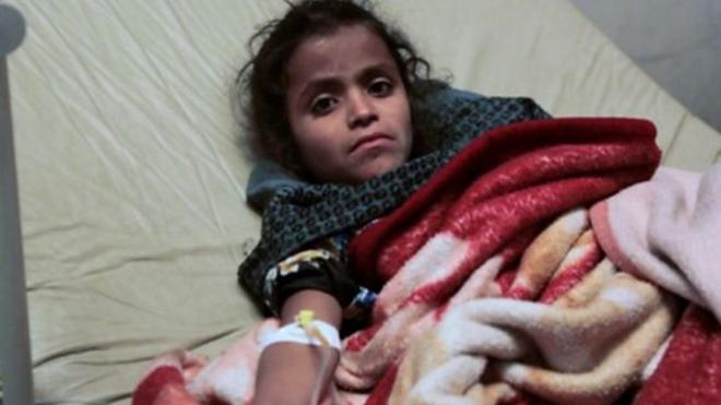 ارتفاع وفيات الكوليرا في اليمن