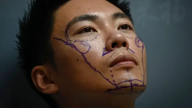 為提升人生機遇而做美容手術的中國男人們