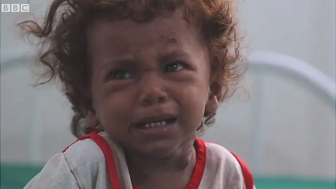 Ємен опинився на порозі найгіршого за 100 років голоду