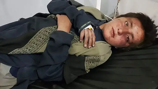 ఖోస్త్ ప్రావిన్స్‌లోని పాకిస్తాన్ దాడుల్లో గాయపడిన బాలుడు