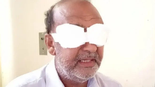 افسر حسین ایک دن صبح اٹھے تو ان کی بینائی جا چکی تھی