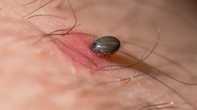 Ticks are masters at feeding without causing any pain or inflammation