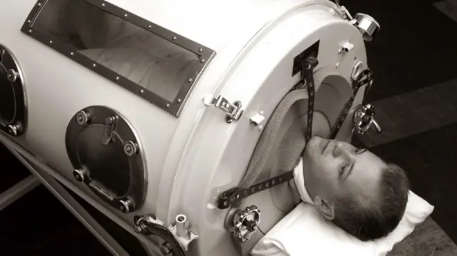 celicna pluca deceija paraliza