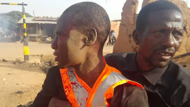 Mid ka mid ah dadkii ku waxyeeloobay iska hor imaadkii ka dhacay magaalada Funtua