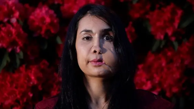 'अफ्गानी महिलाहरू हिंसासँग हार खादैनन्': अनुहारमा गोली हानिएकी महिला