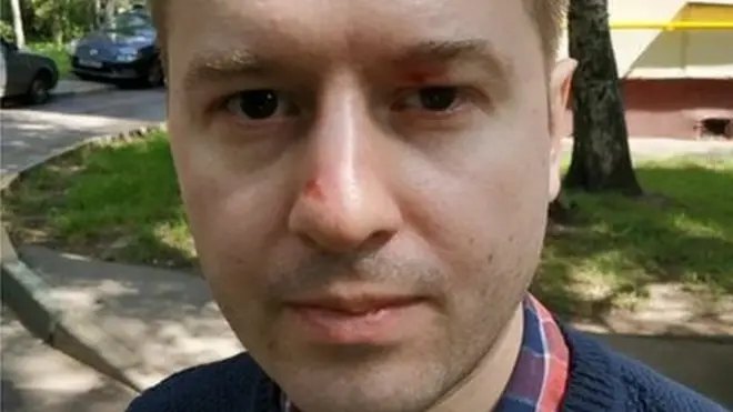 Во время домашнего обыска сотрудника ФБК и представителя Любови Соболь Александра Помазуева избили, утверждает адвокат