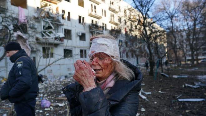 امرأة مصابة في أوكرانيا