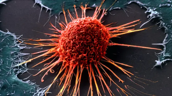 Раковая клетка