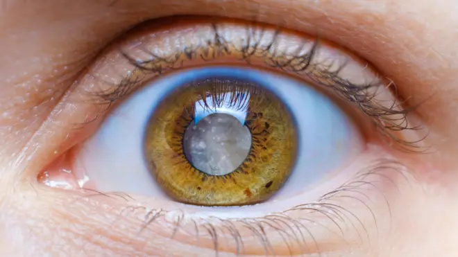 ఆరోగ్యం