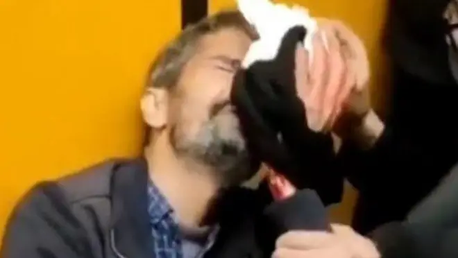 یکی از معترضان در متروی تئاترشهر تهران که هدف شلیک نیروهای امنیتی قرار گرفت و چشمش آسیب دید 