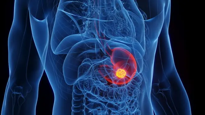 শরীরের ভেতরের অবস্থা বোঝার জন্য এন্ডোসকপি প্রয়োজন হয়।