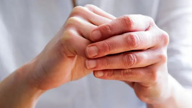 గోళ్లు పసుపు రంగు