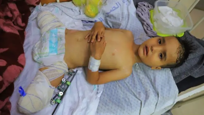 El niño de 3 años Ahmed Shabat en el hospital