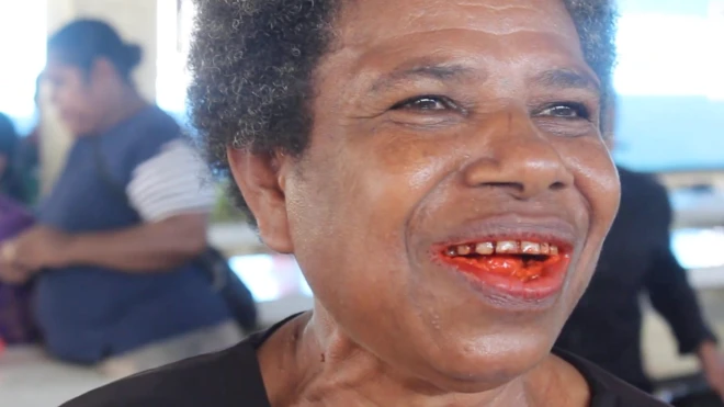 kanker mulut, tradisi pinang, perempuan, Papua