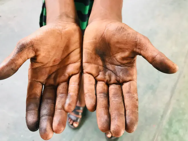 ජාත්‍යන්තර කම්කරු සංවිධානයේ ගණන් බැලීමට අනුව 2020 වසරේ වාර්තා අනුව ලොව පුරා ළමුන් මිලියන 160ක් ශ්‍රමියන් ලෙස සේවයේ යෙදෙනු ලබයි. ඉන් මිලියන 63ක් ගැහැණු දරුවන් වන අතර පිරිමි දරුවෝ මිලියන 97ක් රැකියාවල නිරත වෙති.