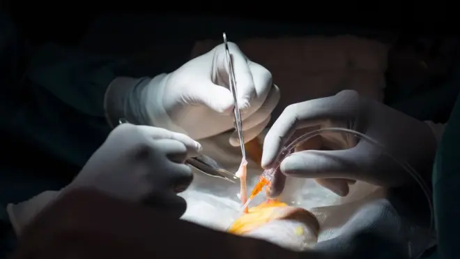 تكرر اكتشاف مجموعات منظمة للتجارة في الأعضاء البشرية في مصر في السنوات القليلة الماضية