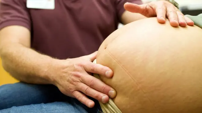 У МОЗ кажуть, що анемію минулого року діагностували майже 100 тисячам майбутніх матерів в Україні