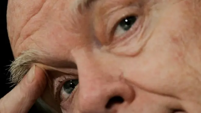 ริ้วรอย