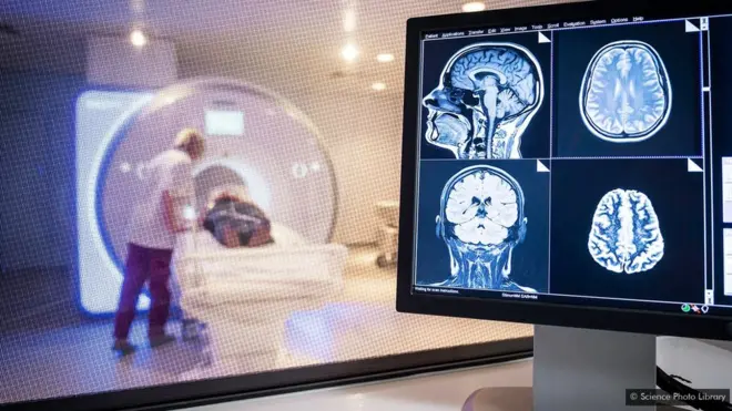 መርመራ ኤምኣርኣይ