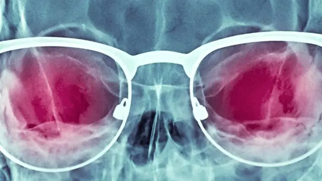 Рентгеновские очки