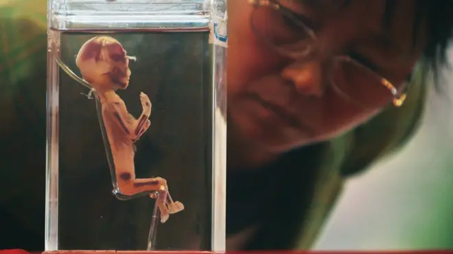 Different opinion dey about whether e dey right to dey chook hand change human DNA