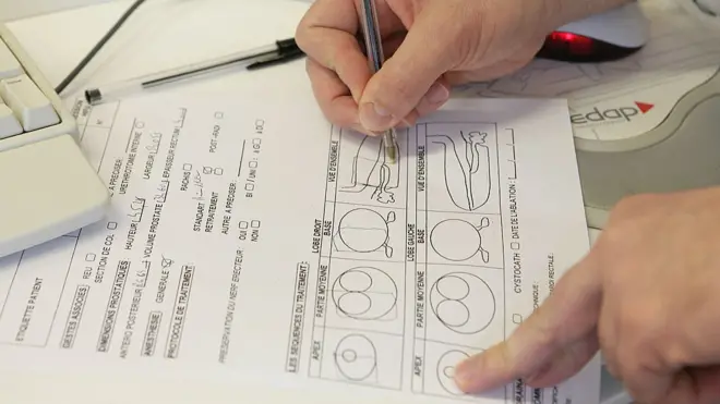 Лікування простати