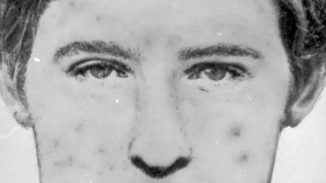 فاتل کا چیچک زدہ چہرے کا خاکہ