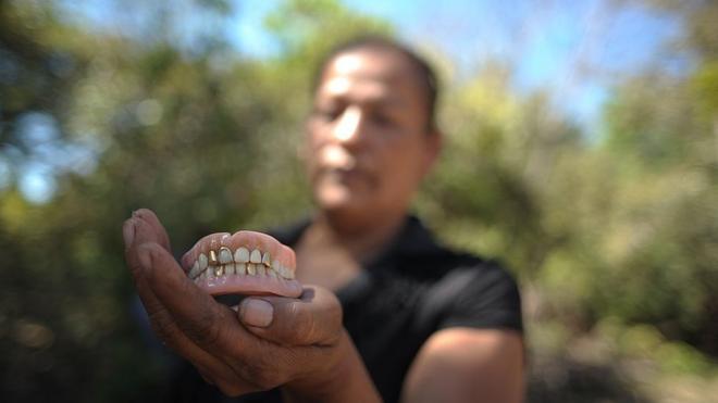 Míriam Núñez de Márquez muestra la dentadura postiza de su madre, víctima de la masacre de El Mozote.