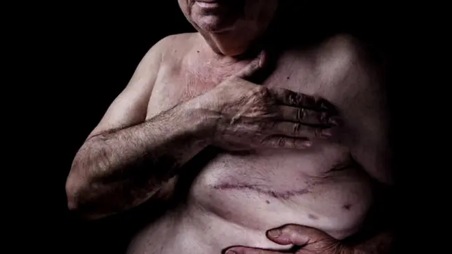 Пожилой мужчина прикрывает рукой голую грудь