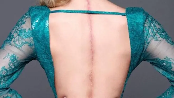 ویکتوریا د کمیس پرانیستلو سره خپل ټپونه وښودل