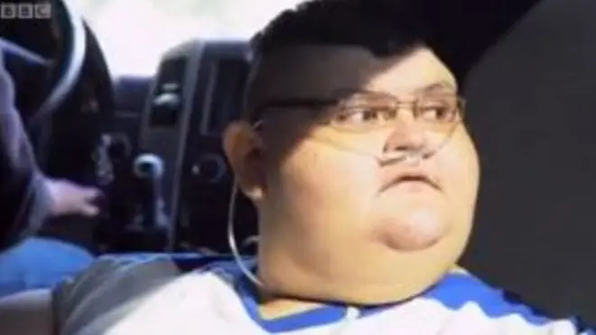 Із вагою 595 кг Хуан Педро Франко півроку тому був найважчою людиною планети