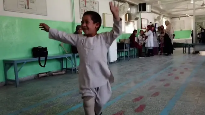 Это уже четвертый протез Ахмеда.