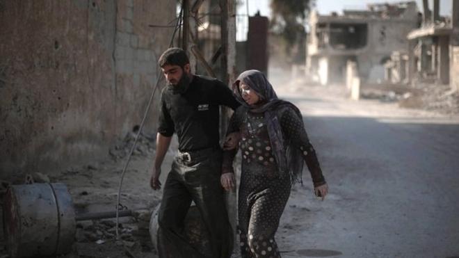 A Syrian man escorts his injured wife following air strikes on the town of al-Nashabiyah in the eastern Ghouta region, 14 Dec