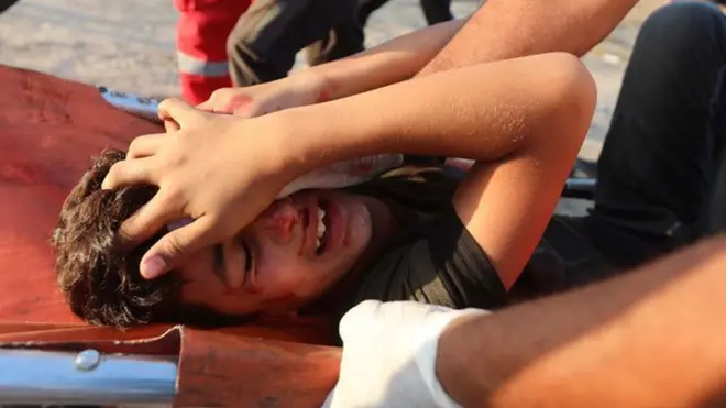 Según el informe de Amnistía Internacional, Carabineros ha utilizado escopetas de forme "injustificada, indiscriminada y en muchos casos apuntando a la cabeza".