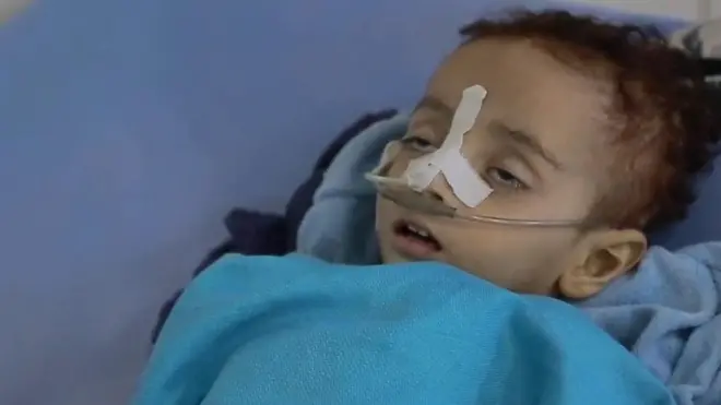 เด็กในเยเมน