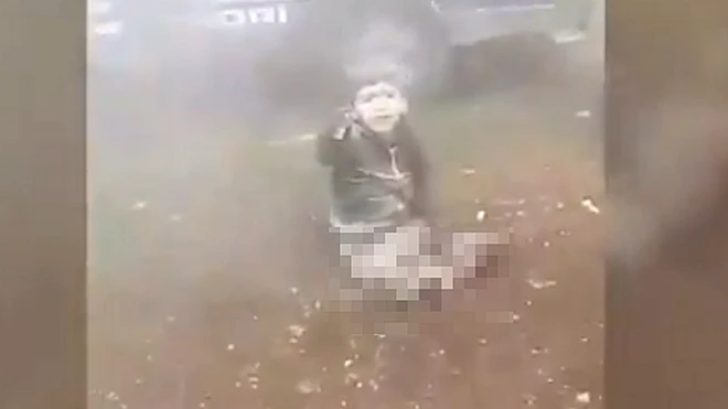 صورة للطفل مبتور الساقين