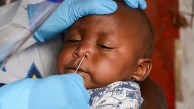 يعتقد الخبراء أن الفحوصات التي أجريت في أفريقيا غير كافية وأن العدد الحقيقي للحالات أعلى