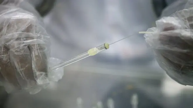 kontrasepsi, seks, kb, perempuan, kelahiran, kondom, vasektomi