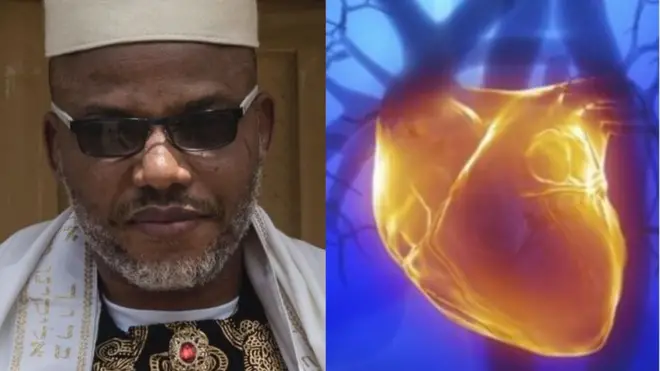 Ọkaiwu Nnamdi Kanu kwuru na ọ na-arịa ọrịa 'Heart Murmur'