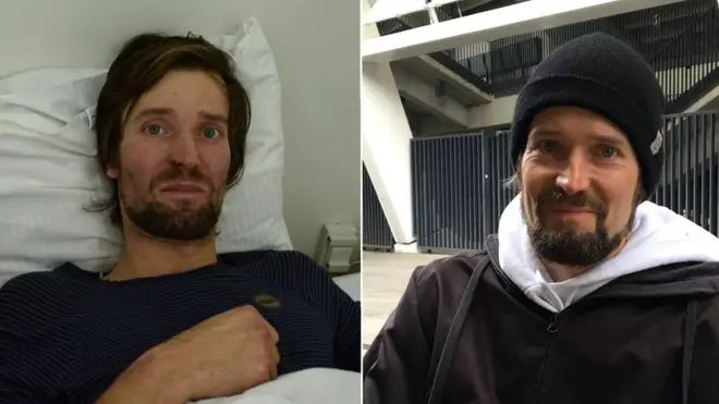 Ігор після порятунку та через кілька місяців