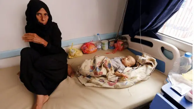 الحرب في اليمن تسببت فيما أطلقت عليه الأمم المتحدة رسميا أكبر أزمة إنسانية في العالم