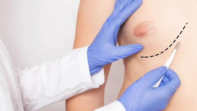 Kanseri y'ibere ntifata abagore gusa kuko n'abagabo irafata...