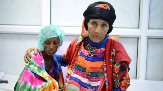 آثار الكارثة الإنسانية في اليمن تبدو على فتاة في العقد الثاني من عمرها