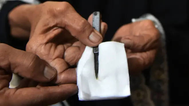 ختان الإناث