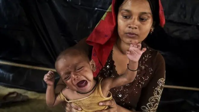 La desnutrición es un problema que afecta a más de 150 millones de niños en todo el mundo, según la OMS.