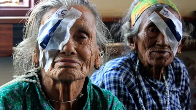 आँखा उपचारका क्रममा महिलाहरू।