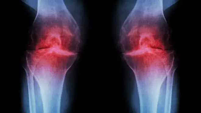 ነድሪ መላግቦ