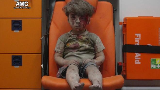 Раненый в результате авиаудара мальчик в Алеппо, фото предоставлено сирийскими активистами
