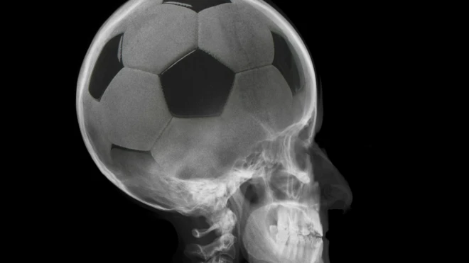 El fútbol es una "exhibición triunfal" de la increíble plasticidad del cerebro humano, opina el neurólogo Jeffrey Holt.