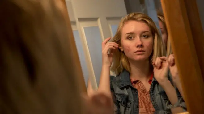 ખીલ અને ખોરકાનો સંબંધ